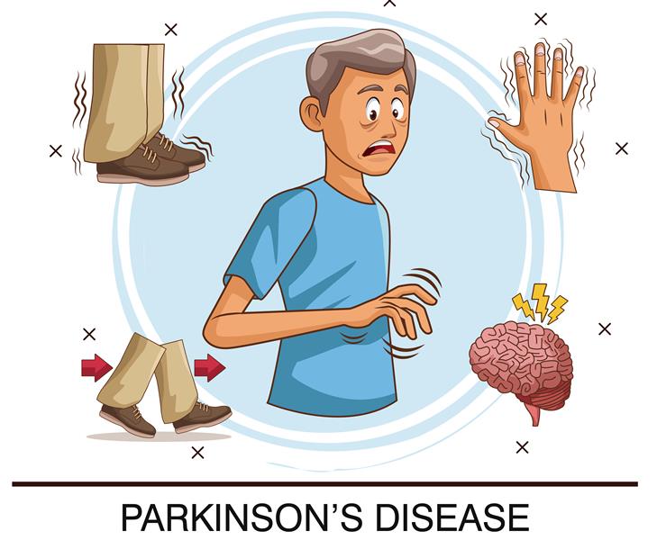 parkinsons_dottor_caliendo